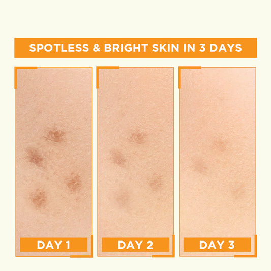 Garnier Bight Complete Vitamin C Booster Serum 30 ml - Contains Niacinamide