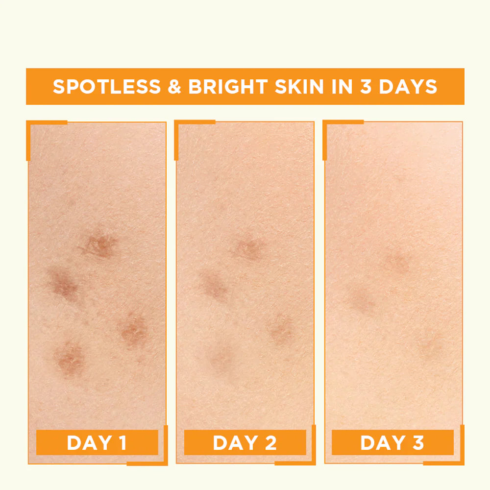 Garnier Bight Complete Vitamin C Booster Serum 30 ml - Contains Niacinamide